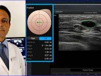 L’ecografia multiparametrica e l’AI si alleano contro il tumore al seno