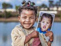 Al via la campagna di “Operation Smile”. Progetto Merry Smiles