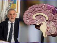 Ictus cerebrale, tutto ciò che bisogna sapere: intervista al prof. Silvestrini