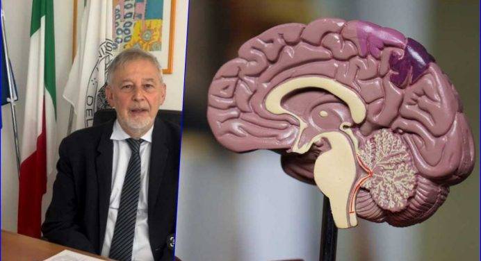 Ictus cerebrale, tutto ciò che bisogna sapere: intervista al prof. Silvestrini